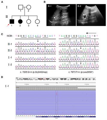 Mosaic PKHD1 in Polycystic Kidneys Caused Aberrant Protein Expression in the Mitochondria and Lysosomes